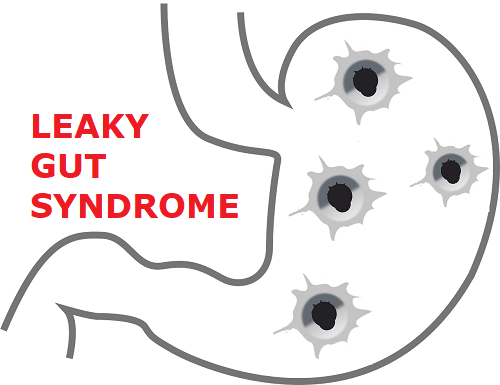 leaky gut syndrome MCTD